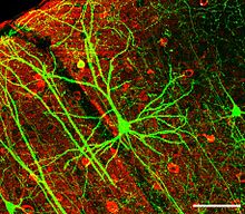 A bright green cell is seen against a red and black background, with long, highly branched, green processes extending out from it in multiple directions.